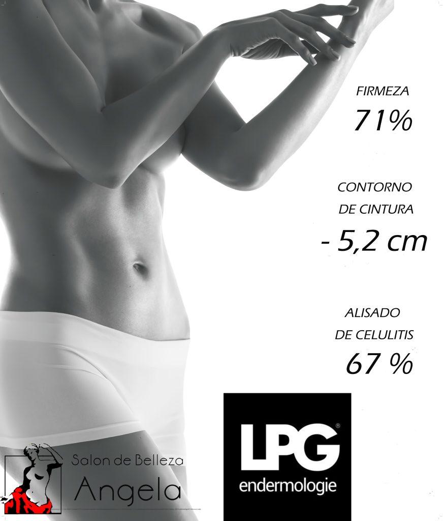 LPG_cordoba